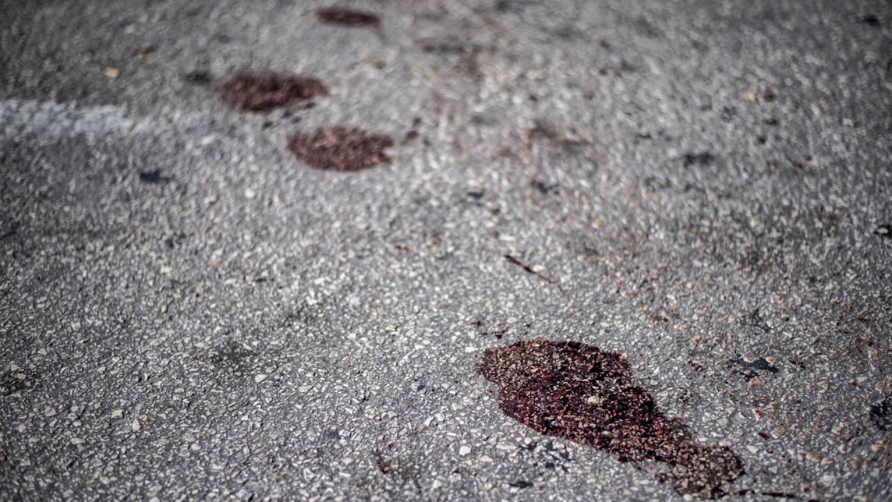 Homem arranca à dentada parte de orelha de policial